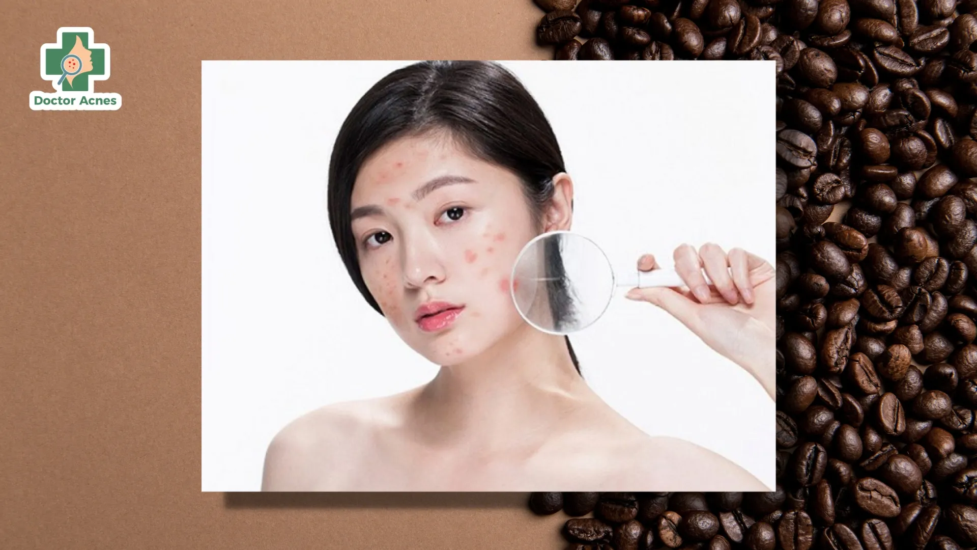 Kiểm soát chặt chẽ điều kiện ánh sáng và độ ẩm là điều kiện tiên quyết trong cách chăm sóc cây cà phê con