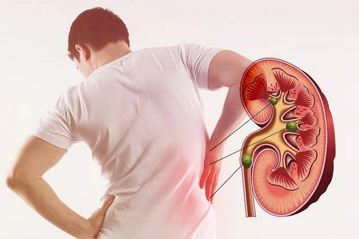 Sử dụng cà phê có cả lợi ích và rủi ro cho thận